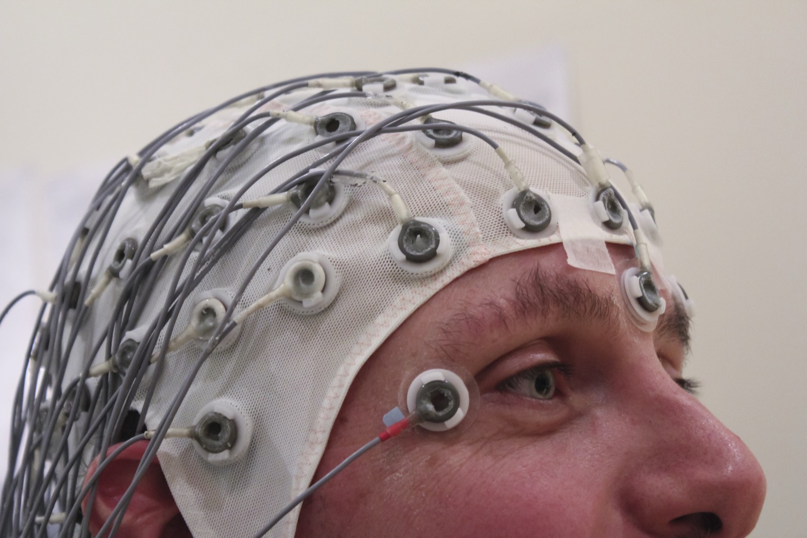 High-density EEG cap