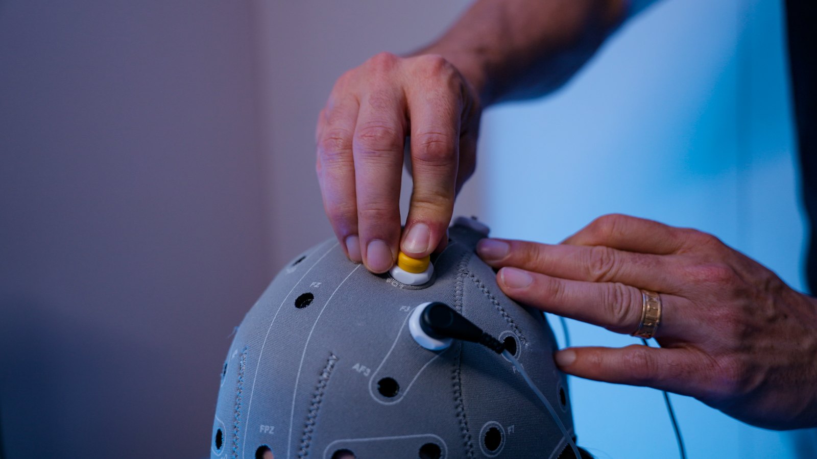 Close-up of electrodes being placed into the stimulation head cap